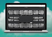 Teeth